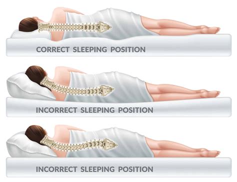 5 Tips to Improve Your Neck Posture While Sleeping